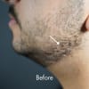 MAN-UP Beard Filler