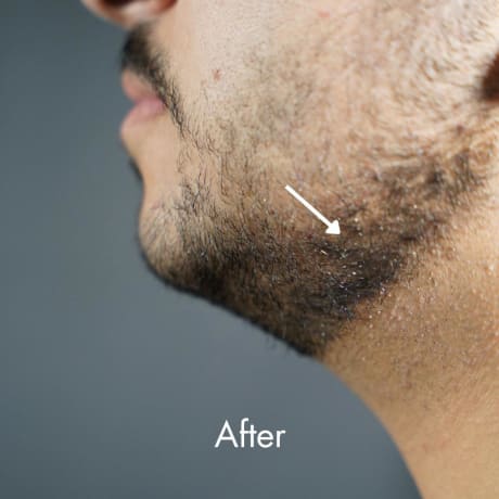 MAN-UP Beard Filler