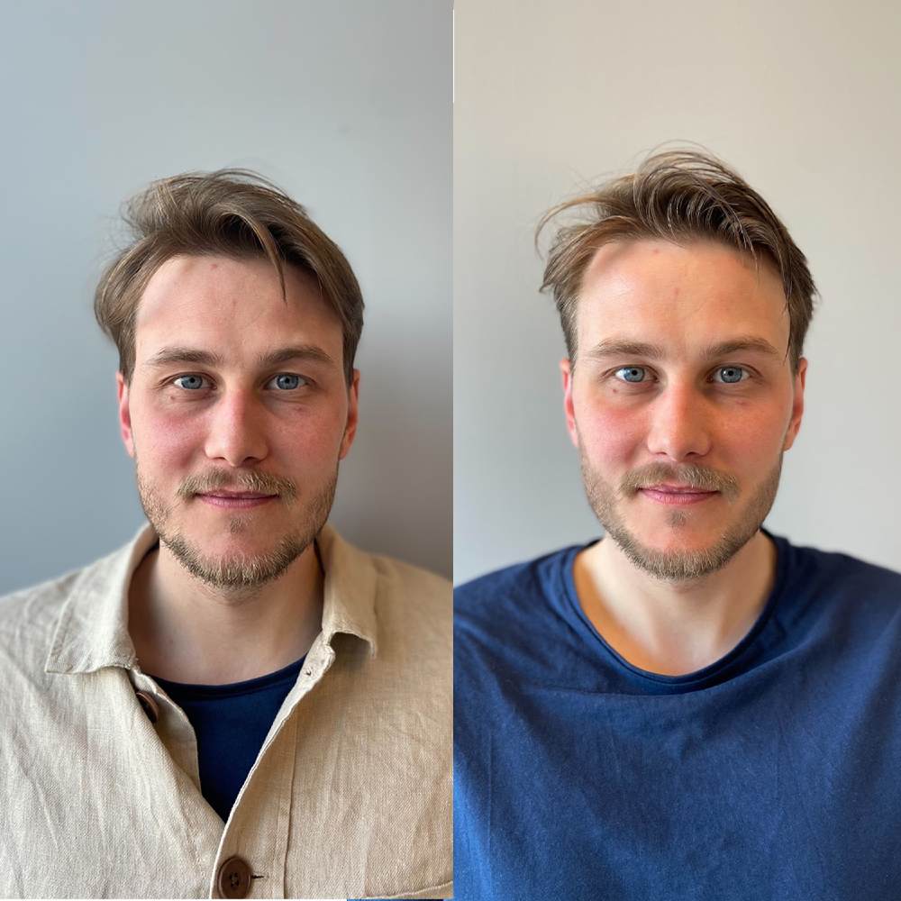 Före och efter kalle